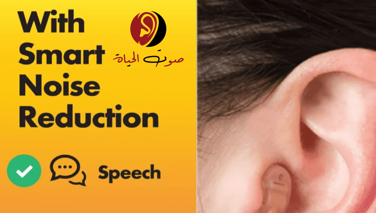 الفرق بين السماعات الالمانية وغيرها التقليد